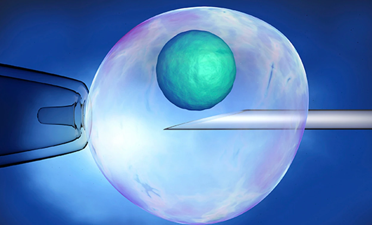 Laser Assisted Hatching
