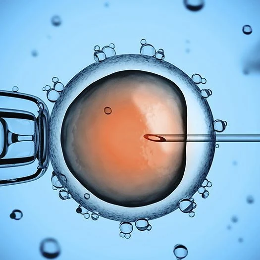 ICSI – Intra-Cytoplasmic Sperm Injection