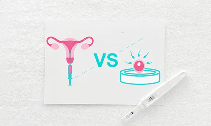 IUI and IVF