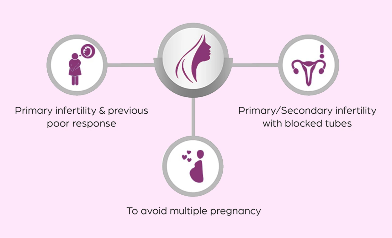 Natural Cycle IVF